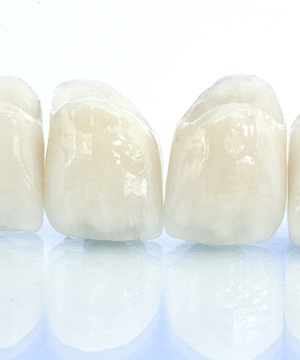 all-ceramic dental bridge on blue background
