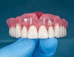 Example of dentures at Esparza Family Dentistry